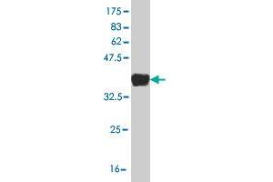 Western Blot detection against Immunogen (36. (BLVRB 抗体  (AA 107-206))