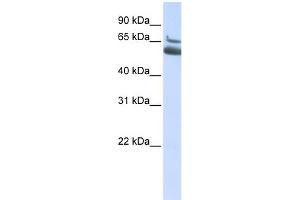 WB Suggested Anti-ALOX15B Antibody Titration:  0. (ALOX15B 抗体  (N-Term))