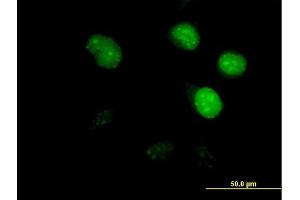 Immunofluorescence of purified MaxPab antibody to CDCA8 on HeLa cell. (CDCA8 抗体  (AA 1-280))