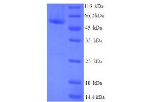 SDS-PAGE (SDS) image for Cytosolic Iron-Sulfur Protein Assembly 1 (CIAO1) (AA 1-339), (full length) protein (His-SUMO Tag) (ABIN4975728) (CIAO1 Protein (AA 1-339, full length) (His-SUMO Tag))