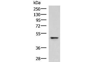 Western blot analysis of Human fetal liver tissue lysate using RMDN2 Polyclonal Antibody at dilution of 1:750 (FAM82A1 抗体)