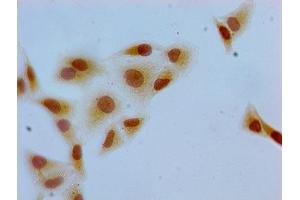 Immunocytochemistry analysis of Hela cells using ABIN7139607 at dilution of 1:100 (H2AFZ 抗体  (meLys7))