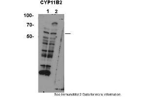 Western Blotting (WB) image for anti-Cytochrome P450, Family 11, Subfamily B, Polypeptide 2 (CYP11B2) (Middle Region) antibody (ABIN2776971)
