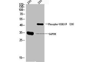 Western Blot analysis of 293 cells using Phospho-GSK3β (S9) Polyclonal Antibody (GSK3 beta 抗体  (pSer9))