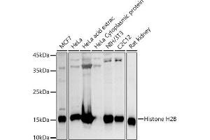 Western blot analysis of extracts of various cell lines, using Histone H2B antibody (ABIN3015764, ABIN3015765, ABIN3015766 and ABIN6219109) at 1:1000 dilution. (Histone H2B 抗体  (AA 1-126))