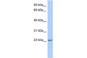 WB Suggested Anti-TRAPPC5 Antibody Titration: 0. (TRAPPC5 抗体  (Middle Region))
