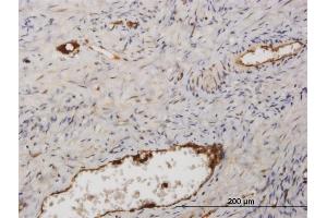 Immunostaining (ISt) image for anti-Fibrinogen alpha Chain (FGA) (AA 1-218) antibody (ABIN515602)
