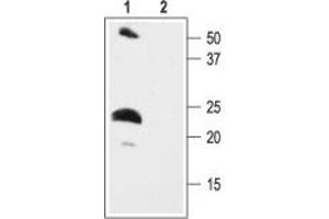 KCNE2 抗体  (C-Term, Intracellular)