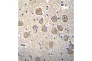 Immunohistochemistry (Paraffin-embedded Sections) (IHC (p)) image for anti-Olfactory Receptor, Family 4, Subfamily K, Member 2 (OR4K2) (AA 283-312), (C-Term) antibody (ABIN953860)