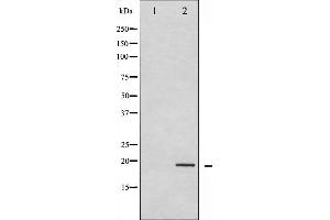 Western blot analysis of Synuclein- alpha phosphorylation expression in Etoposide treated 293 whole cell lysates,The lane on the left is treated with the antigen-specific peptide.