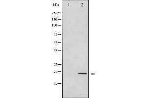 Western blot analysis of Synuclein- alpha phosphorylation expression in Etoposide treated 293 whole cell lysates,The lane on the left is treated with the antigen-specific peptide. (SNCA 抗体  (pTyr133))