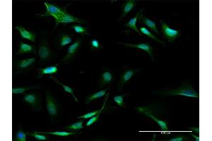 Immunofluorescence of purified MaxPab antibody to GALT on HeLa cell. (GALT 抗体  (AA 1-379))