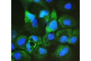IF analysis of ARA9/AIP using anti-ARA9/AIP antibody (ABIN6719423).