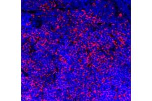 Immunofluorescence of paraffin embedded mouse lymph node using IL-27A (ABIN7074367) at dilution of 1: 800 (400x lens) (IL27 抗体)