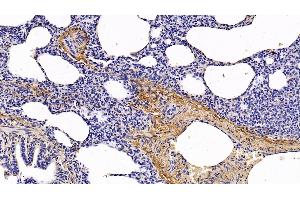 Immunohistochemistry (IHC) image for anti-Collagen, Type I, alpha 1 (COL1A1) (AA 1218-1440) antibody (ABIN7425806)