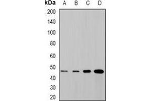 Western blot analysis of SYT4 expression in SHSY5Y (A), NIH3T3 (B), mouse brain (C), rat brain (D) whole cell lysates. (SYT4 抗体)
