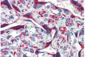 Placenta, Human: Formalin-Fixed, Paraffin-Embedded (FFPE) (IGFBP4 抗体  (AA 180-229))