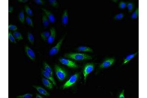 Immunofluorescent analysis of Hela cells using ABIN7142632 at dilution of 1:100 and Alexa Fluor 488-congugated AffiniPure Goat Anti-Rabbit IgG(H+L) (HTR3D 抗体  (AA 107-210))