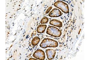 Phospho-4E-BP1 (Thr37/Thr46) Antibody at 1/100 staining Rat stomach tissue by IHC-P.