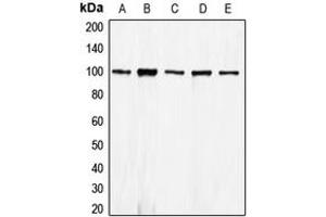 Western Blotting (WB) image for anti-Cadherin 1, Type 1, E-Cadherin (Epithelial) (CDH1) (N-Term) antibody (ABIN7295212)