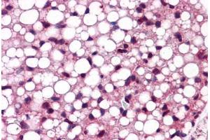 Mouse Adipose: Formalin-Fixed, Paraffin-Embedded (FFPE) (ATF6 抗体  (C-Term))