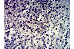 Immunohistochemistry (IHC) image for anti-MutS Homolog 6 (E. Coli) (MSH6) (AA 374-540) antibody (ABIN7193706)