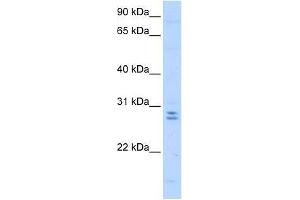 Western Blot showing MED4 antibody used at a concentration of 0. (MED4 抗体  (C-Term))