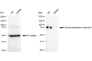 Western blotting analysis using Stromal interaction molecule 1 antibody (ABIN7800445). (Recombinant STIM1 抗体)