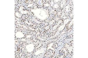 IHC analysis of SNRNP40 using anti-SNRNP40 antibody (ABIN7601719). (SNRNP40 抗体  (AA 43-357))