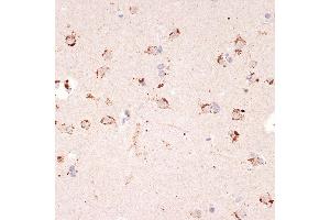 Immunohistochemistry of paraffin-embedded human brain using Ephrin  Rabbit mAb (ABIN7266976) at dilution of 1:100 (40x lens). (Ephrin A1 抗体)