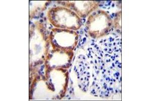 Immunohistochemistry (Paraffin-embedded Sections) (IHC (p)) image for anti-Succinate Dehydrogenase Complex, Subunit D, Integral Membrane Protein (SDHD) (AA 20-50), (N-Term) antibody (ABIN954695)