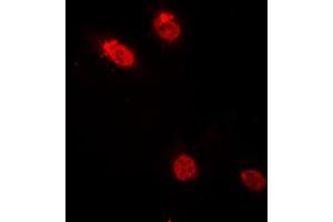 Immunofluorescent analysis of c-Myb staining in HeLa cells. (MYB 抗体  (N-Term))