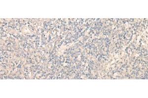 Immunohistochemistry of paraffin-embedded Human tonsil tissue using PITPNB Polyclonal Antibody at dilution of 1:25(x200) (PITPNB 抗体)