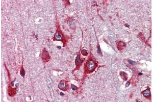 Immunohistochemistry (Paraffin-embedded Sections) (IHC (p)) image for anti-Transcription Factor AP-2 gamma (Activating Enhancer Binding Protein 2 Gamma) (TFAP2C) (AA 252-301) antibody (ABIN6741554)