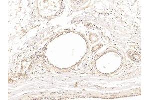 Immunohistochemistry (IHC) image for anti-Tubulin, beta (TUBB) (AA 170-419) antibody (ABIN7443818)
