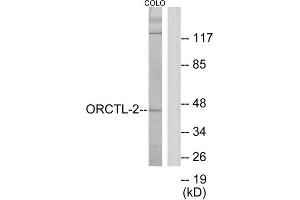 Western Blotting (WB) image for anti-Solute Carrier Family 22 Member 18 (SLC22A18) (C-Term) antibody (ABIN1849892) (ORCTL-2/SLC22A18 抗体  (C-Term))