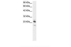 Image no. 2 for anti-Regulator of G-Protein Signaling 20 (RGS20) (AA 127-176) antibody (ABIN202110) (RGS20 抗体  (AA 127-176))
