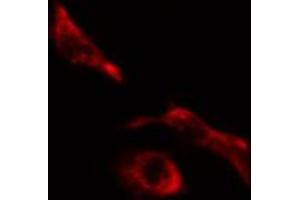 Immunofluorescence (fixed cells) (IF/ICC) image for anti-Collagen, Type V, alpha 1 (COL5A1) (Internal Region) antibody (ABIN6257109)