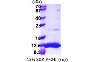 Ubiquitin-Like 5 (UBL5) (AA 1-73) protein (His tag)