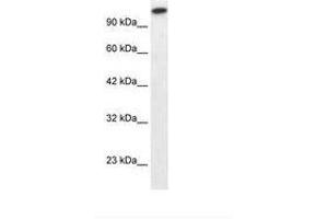 Image no. 1 for anti-GLI Family Zinc Finger 2 (GLI2) (AA 600-649) antibody (ABIN202982) (GLI2 抗体  (AA 600-649))
