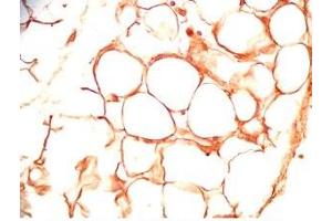 Rat visceral fat tissue was stained by Rabbit Anti-sFRP-2 (25-50) (Human) Antiserum (SFRP2 抗体  (AA 25-50))
