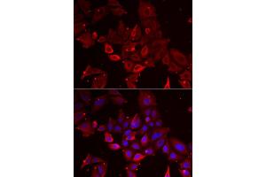 Immunofluorescence analysis of U2OS cell using MYOT antibody. (Myotilin 抗体)