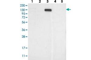Western blot analysis of Lane 1: RT-4, Lane 2: U-251 MG, Lane 3: Human Plasma, Lane 4: Liver, Lane 5: Tonsil with MKL1 polyclonal antibody  at 1:250-1:500 dilution. (MKL1 抗体)