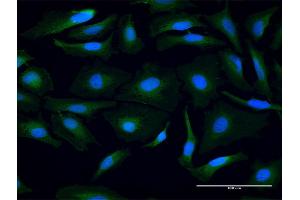 Immunofluorescence of purified MaxPab antibody to PSMB3 on HeLa cell. (PSMB3 抗体  (AA 1-205))