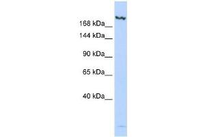 Western Blot showing JMJD3 antibody used at a concentration of 1-2 ug/ml to detect its target protein. (Kdm6b 抗体  (N-Term))
