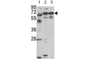 Western blot analysis of Fascin-3 antibody and 1) MDA-MB231, 2) NCI-H460 cell line and 3) mouse testis tissue lysate.