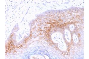 Formalin-fixed, paraffin-embedded human Skin stained with Desmocollin-2/3 Mouse Monoclonal Antibody (7G6). (Desmocollin 2 抗体  (Extracellular Domain))