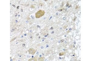 Immunohistochemistry of paraffin-embedded Rat brain using CST1 Polyclonal Antibody at dilution of 1:100 (40x lens). (CST1 抗体)