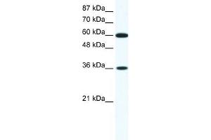 Human Jurkat; WB Suggested Anti-FOXF1 Antibody Titration: 1. (FOXF1 抗体  (N-Term))