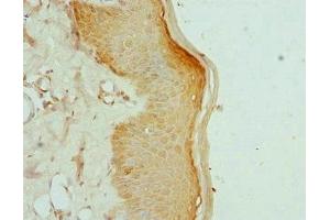 Immunohistochemistry of paraffin-embedded human skin tissue using ABIN7157648 at dilution of 1:100 (KIF2B 抗体  (AA 544-673))